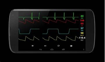 Chero ECG for Android - Download the APK from Habererciyes